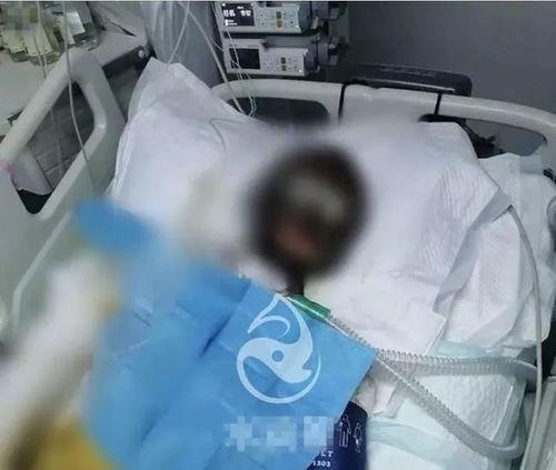 网红被前夫汽油烧伤,一场婚姻的悲剧与重生