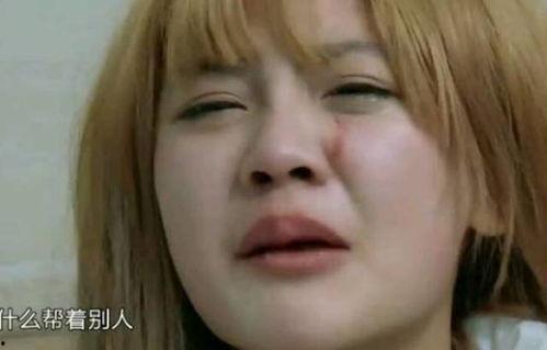网红前男友整容了,颜值逆袭引热议